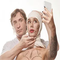 Phẫu thuật thẩm mỹ giống ảnh selfie: Hiện tượng "mặc cảm Snapchat"