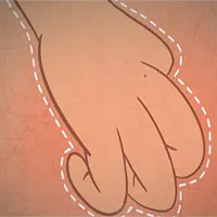 Tại sao gãi ngứa lại dễ chịu đến vậy?