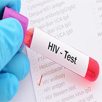 Phát hiện cơ chế giúp chữa khỏi HIV ngay trong não người