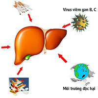 Men gan cao và cách giảm không cần thuốc