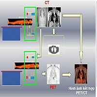 Chụp PET/CT là gì?