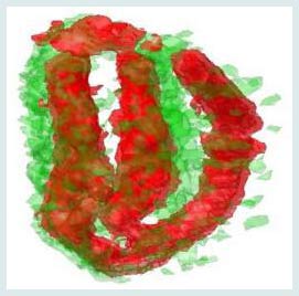 Phát hiện ra nơi và cách thức hạt giống dự trữ sắt.