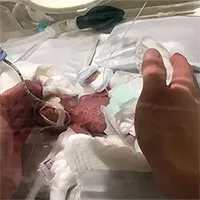 Cậu bé nhỏ nhất thế giới: 268g vẫn sống sót!