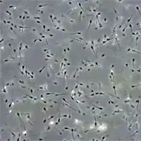 Tinh dịch đông lạnh lâu đời nhất thế giới được thụ tinh thành công