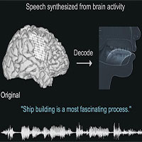 Công nghệ biến tín hiệu não thành lời nói, giúp bệnh nhân bại liệt giao tiếp