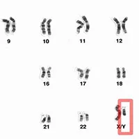 Nhiễm sắc thể giới tính Y đang dần bị thoái hoá