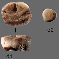 Phát hiện người thời kỷ băng hà ở Siberia thông qua răng sữa