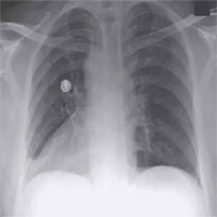 Kỳ lạ người đàn ông có nội tạng đảo ngược