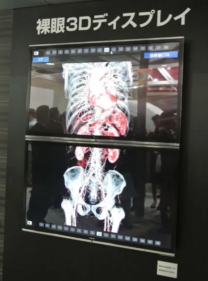 Hình ảnh chụp CT được hiển thị bằng công nghệ 3D