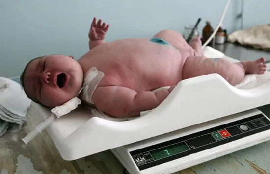 Một thai nhi không khỏe sẽ có những phát triển thiếu bình thường và đó là nguyên nhân khiến cho đứa trẻ khi chào đời có nguy cơ bị rối loạn các chức năng và mắc bệnh tự kỷ.