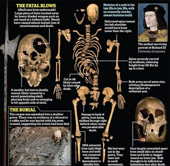 Hình ảnh chi tiết bộ xương vua Richard III sau khi được khai quật