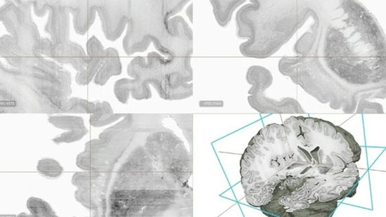 Mô hình bộ não 3D đầu tiên trên thế giới