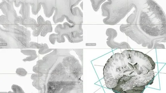 Mô hình bộ não 3D đầu tiên trên thế giới