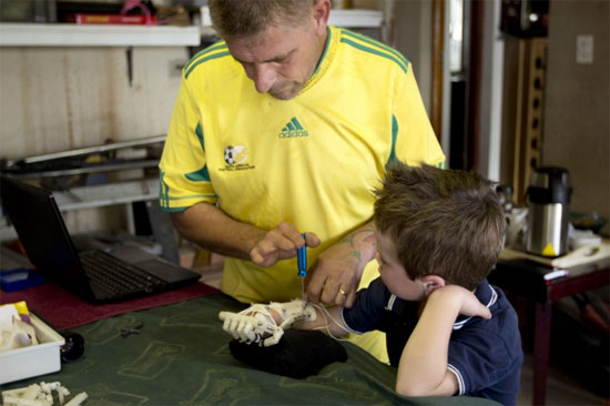 Richard Van As đang lắp ráp tay giả cho cậu bé Liam Dippenaar