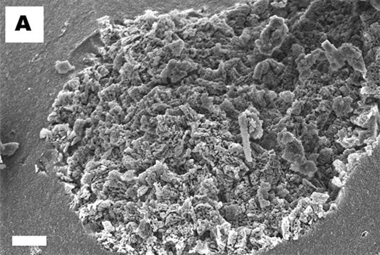 Vật liệu hấp thụ nước siêu việt