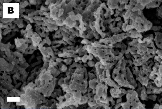 Vật liệu hấp thụ nước siêu việt