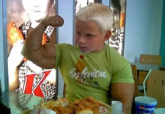 Một trường hợp khác của bệnh rối loạn Myostatin