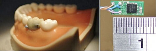 Cảm biến mới theo dõi thói quen ăn uống ở người