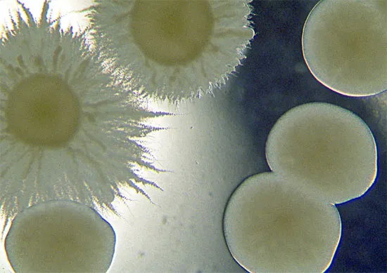 Nấm Cryptococcus neoformans