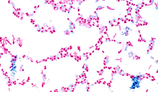 Cận cảnh vi khuẩn Clostridium botulinum - thủ phạm sản sinh ra độc tố botulinum