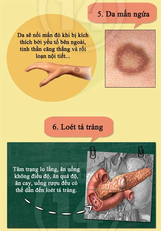 Dấu hiệu cho thấy cơ thể bạn đang "kêu cứu"
