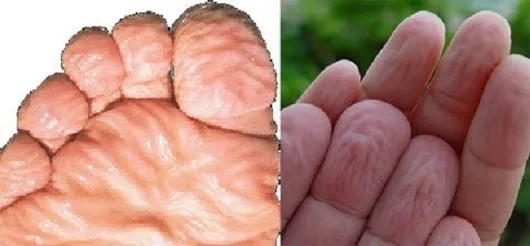 Sau 30 phút - 1 giờ đồng hồ, da ở lòng bàn tay, bàn chân bắt đầu trắng nhợt vì ngâm nước
