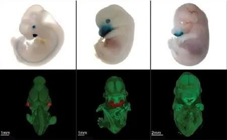 Nhận diện ADN quyết định hình dạng mặt