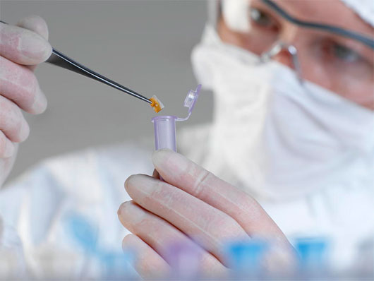 Thu thập mẫu máu tại hiện trường hiện vẫn dựa trên kỹ thuật cũ