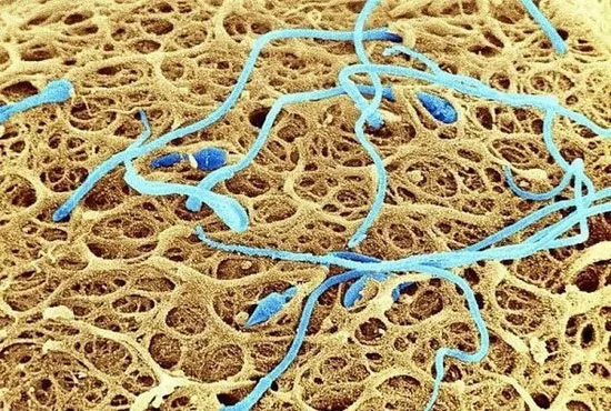 Tinh trùng trên bề mặt của một quả trứng người