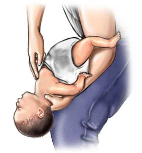 Trẻ bị mắc dị vật
