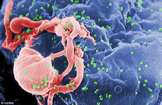 Virus HIV đã gây bệnh AIDS cho khoảng 35 triệu người trên toàn cầu