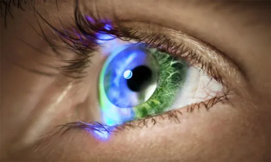Kính sát tròng iOptik