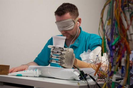 Dennis Aabo Sørensen trong thí nghiệm cầm nắm bằng cánh tay giả