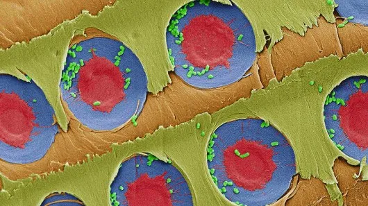 Vi khuẩn E.coli màu xanh bị giữ lại trên màng lõm trong gỗ dác của cây thông