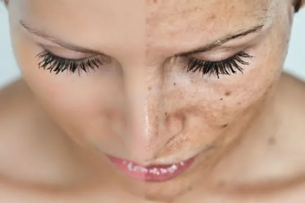 Ngăn ngừa lão hóa sớm