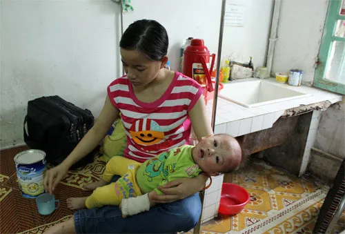 Năm nay bệnh sởi bùng phát và có nhiều ca bệnh lạ. Số đông trẻ em dưới 1 tuổi mắc bệnh