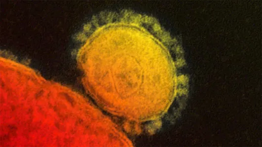 Virus nguy hiểm MERS vẫn chưa có thuốc điều trị