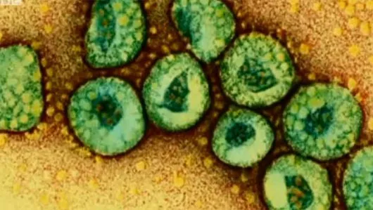 Virus MERS được phát hiện lần đầu tiên vào mùa xuân năm 2012