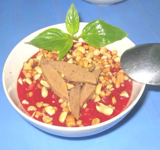 Bệnh nhân có 50 ổ sán trong não