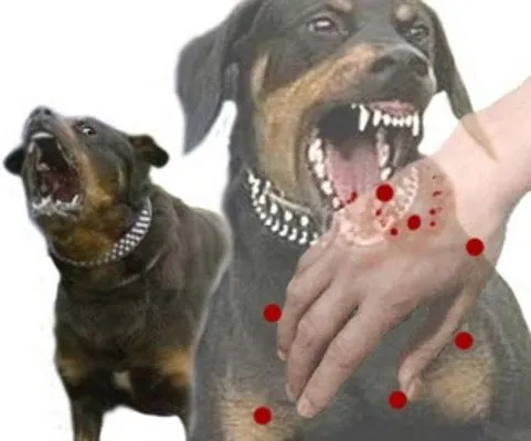 Xử trí điều trị dự phòng bệnh dại ở người do chó dại cắn phải bảo đảm nguyên tắc
