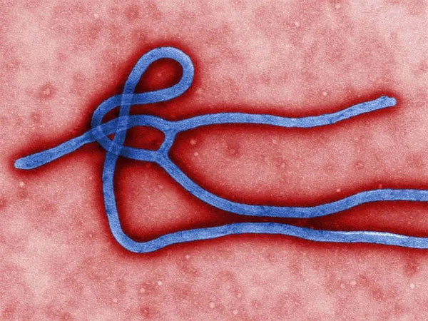 Virus Ebola thuộc loại nguy hiểm nhất hiện nay vì chưa có vắc-xin phòng ngừa và cũng chưa có thuốc điều trị đặc hiệu