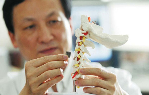 Cấy ghép thành công đốt sống in 3D lên cơ thể người