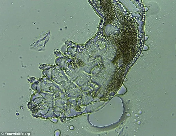 Loài Demodex folliculorum