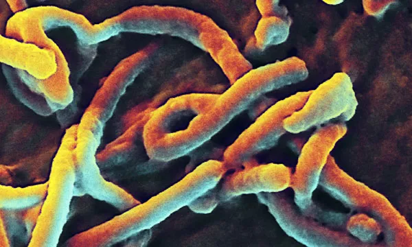 Virus Ebola dưới kính hiển vi