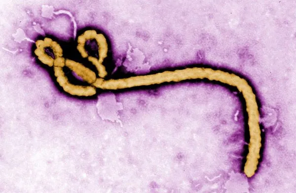 Máu của các bệnh nhân Ebola sống sót được cho là chứa các kháng thể tự nhiên chống lại virus nguy hiểm này.