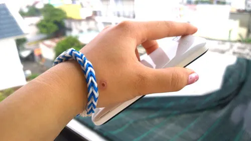 Một số nữ sinh bị dị ứng nổi mẩn ngứa khi đeo vòng thun hand made.
