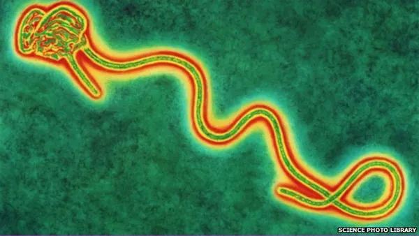 Hình ảnh dưới kính hiển vi của virus Ebola