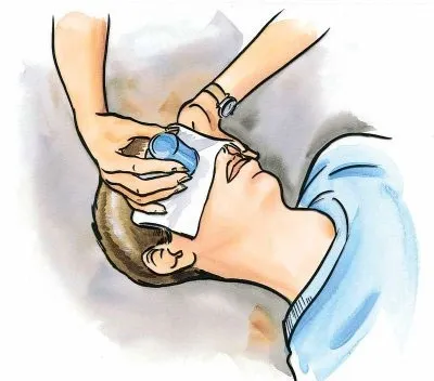 Dùng cốc giấy úp lên mắt bị chấn thương để bảo vệ mắt.