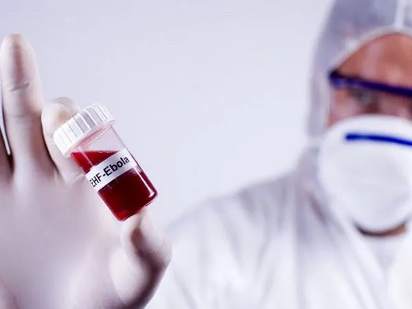 Phát triển kháng thể điều trị Ebola.