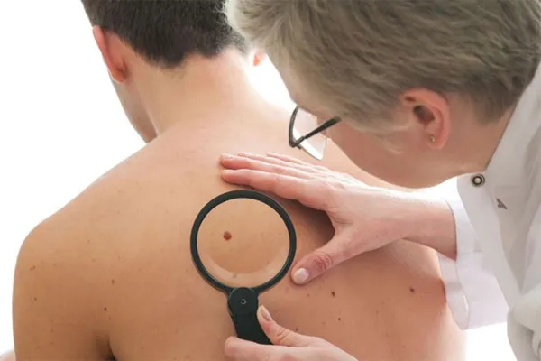 Chẩn đoán bệnh qua làn da